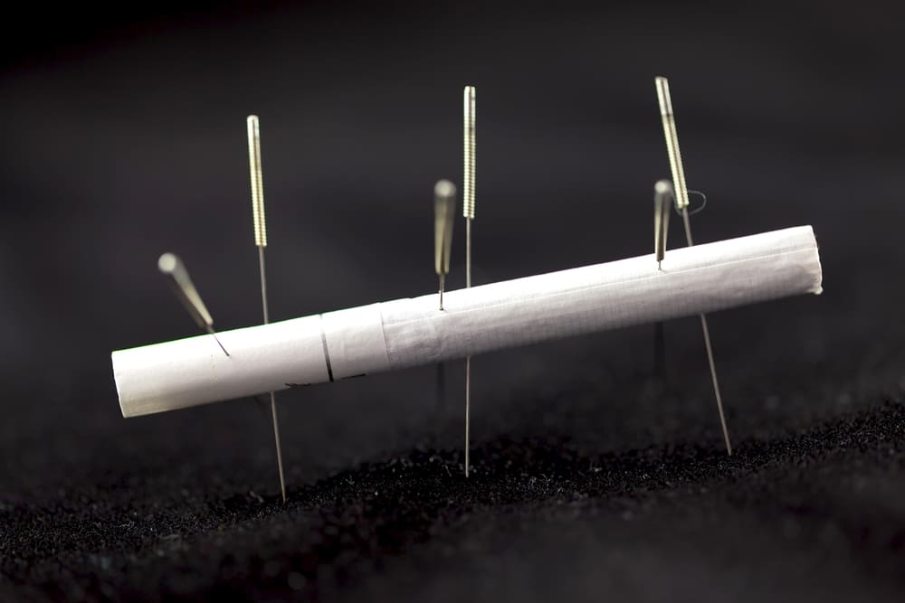 acupunctura pentru a renunța la fumat laserostop laserostop