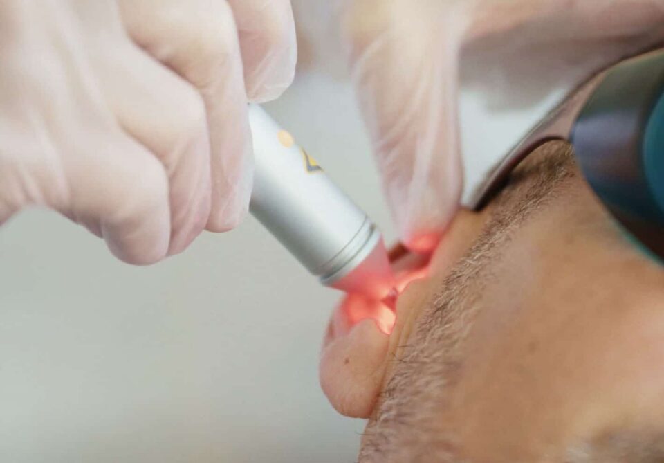 auriculoterapie cu laser laserOstop renunțare la fumat oprirea fumatului Auriculoterapia cu laser laserOstop renunțare la fumat oprirea fumatului