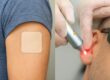 patch cu nicotină laserOstop renunțare la fumat sevraj patch cu nicotină plasture cu nicotină